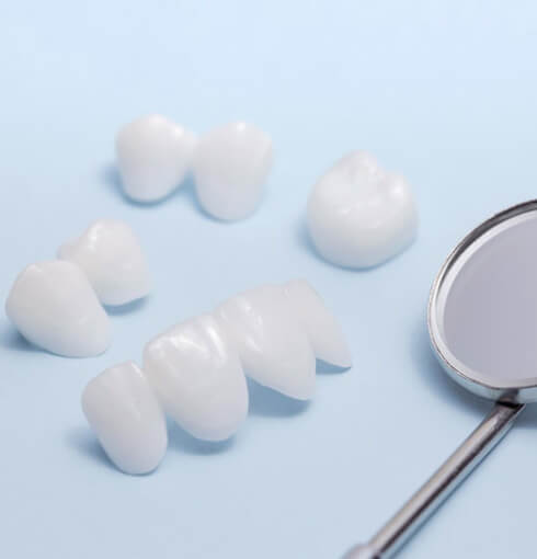 veneers used in cosmetic dentistry at Rolling Hills Family Dentistry custom-made dental restorations for a brighter smile