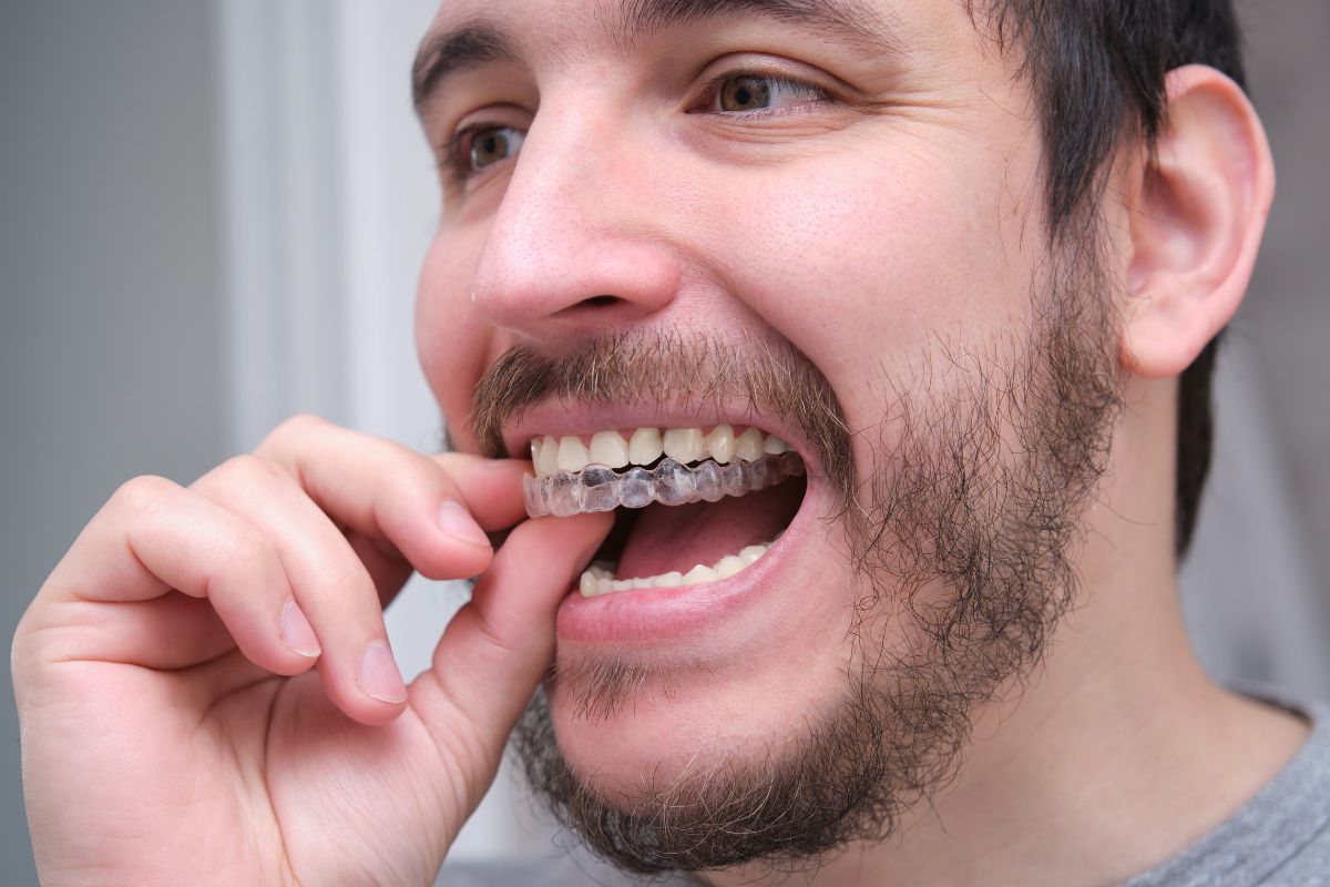 Can Invisalign Fix Bite Issues? What You Should Know First